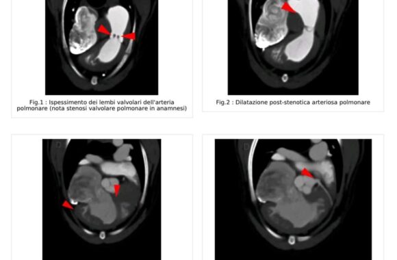 CARDIOTC in un maltipoo di 2 anni con stenosi polmonare